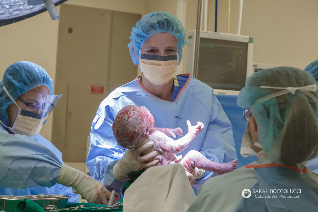 C-Section Birth Boulder, Colorado