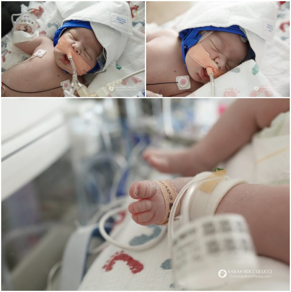 Colorado-NICU-Photographer-Childrens-Hospital