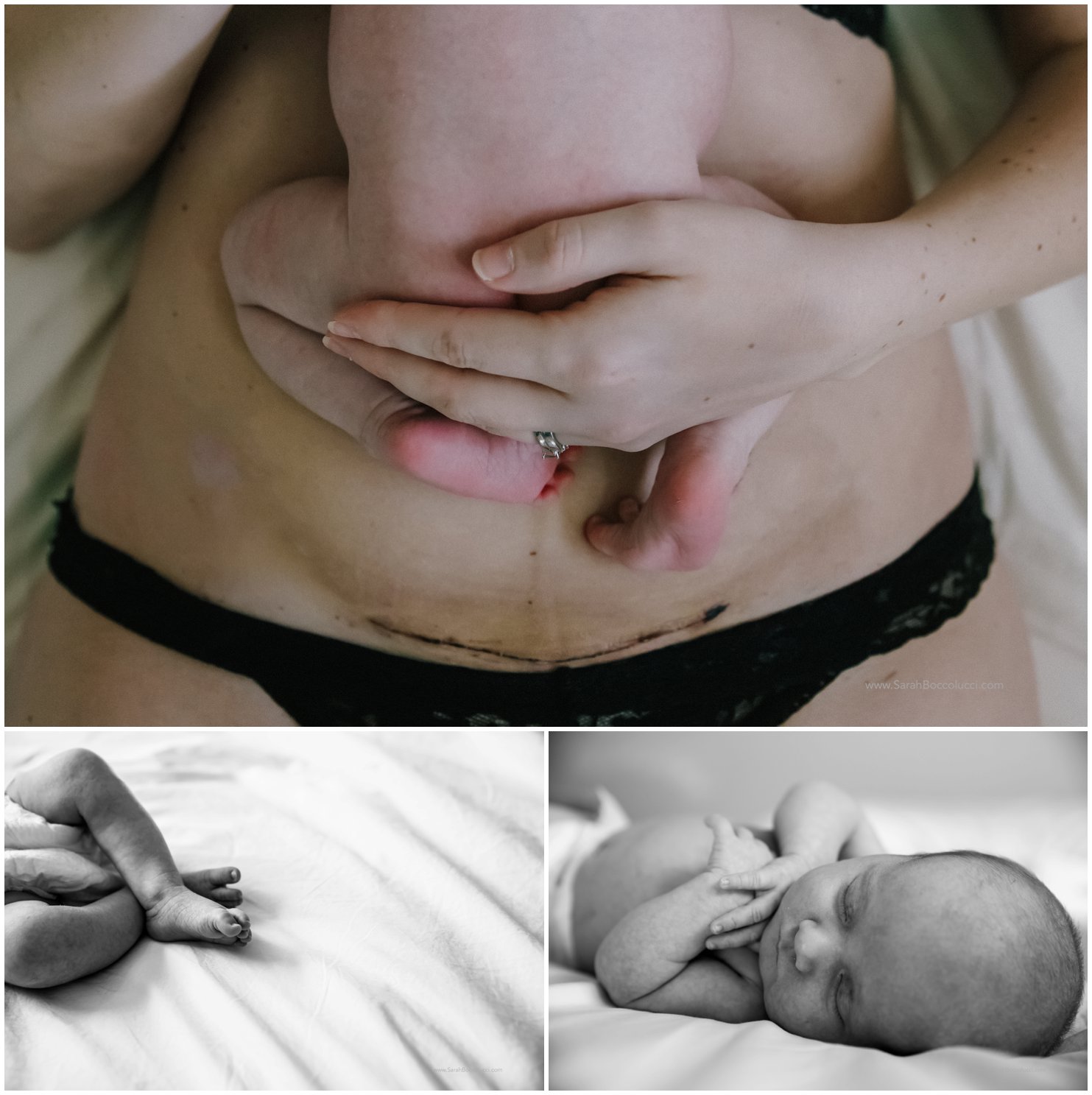Longmont, CO Newborn Photographer, Cesarean birth scar