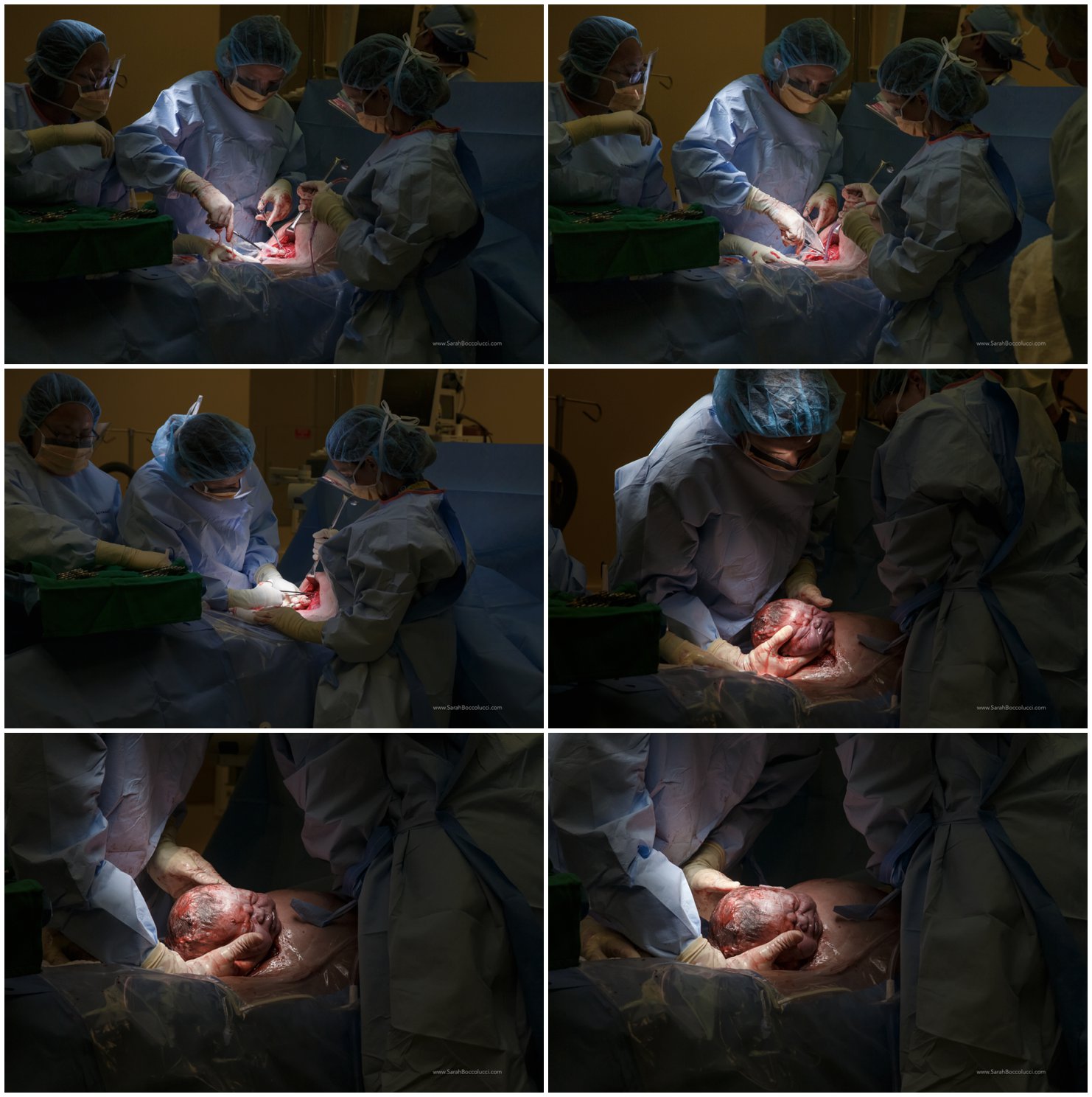 Boulder, CO birth photography, birth via surgery