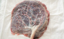 Boulder Placenta Enc