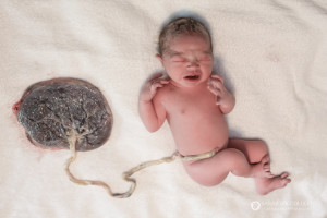 Baby attached to placenta, Denver, Colorado